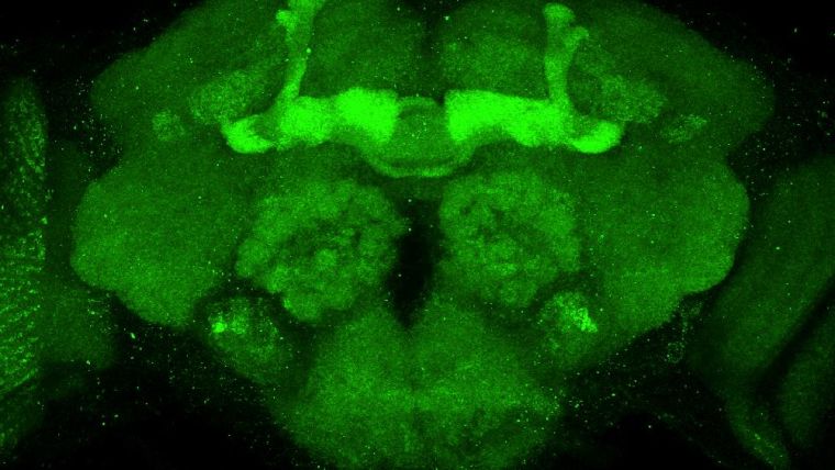 Fluorescent close up of the fly brain showing that a key magnesium transporter dominates the neurons involved in memory.