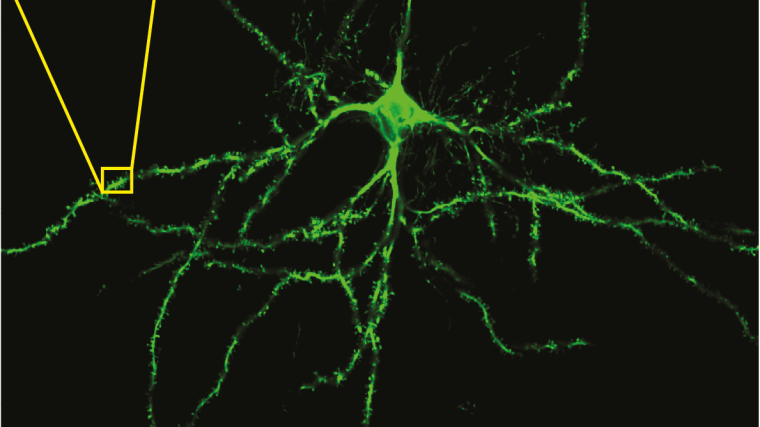 A striatal spiny projection neuron labelled with neurobiotin (scale bar 20 µm; inset 2 µm).
