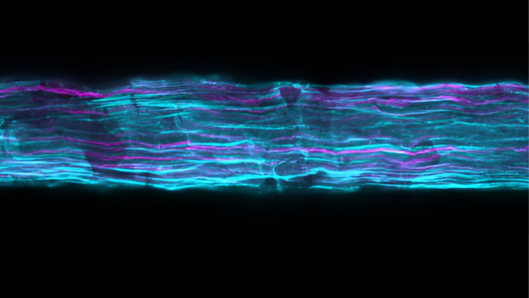 Nerve in cyan and magenta