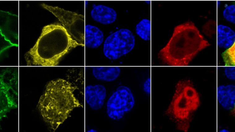 Upper panel: Rest
Lower panel: stimulated

Images from left:
Orai1-GFP
STIM1-YFP
DAPI (nuclear stain)
NFAT-cherry
All merged