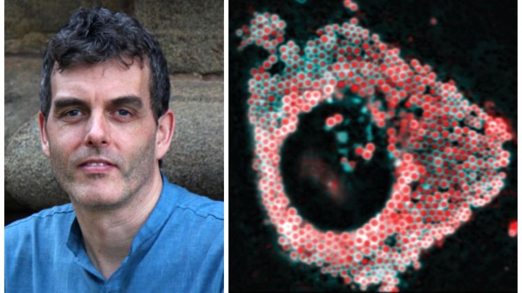 Image of Professor Robin Klemm on left and image of lipid droplets featured on the front cover of the special issue is on the right.