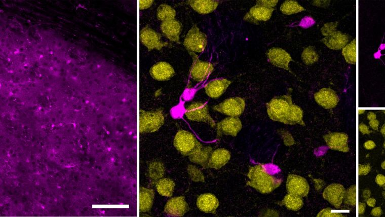 Striatal immunofluorescence signals for astrocyte marker S100β and neuronal marker NeuN