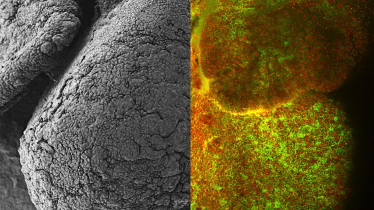 This image shows the developing heart of a mouse embryo captured using an electron microscope (left) and a laser microscope (right). In the black and white image we can see how cells in a developing heart don’t form a smooth surface. To capture the image on the right cells were stained with two coloured markers - red, to visualise nuclei, and green, to highlight cell boundaries. These red and green cell boundaries show how some cells huddle together in small structures and form strong connections with their neighbours. Other cells end up alone and will dive into the heart to find stronger connections as it continues to develop.