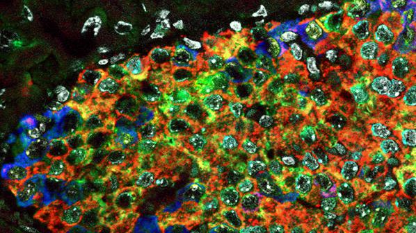 Cells within the skin are represented as an oblong-shaped solid mass of multi coloured, almost mosaic-like structure