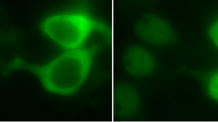Calcium entry through CRAC channels drives the movement of the transcription factor NFAT1 into the nucleus. NFAT is found mainly within the cytoplasm at rest (left hand panel) but moves into the nucleus after stimulation (right hand panel), where it regulates gene expression. Cells were transfected with DNA encoding NFAT1-GFP, enabling real time visualization of transcription factor dynamics. Stimulation involved a physiological trigger that opened CRAC channels.