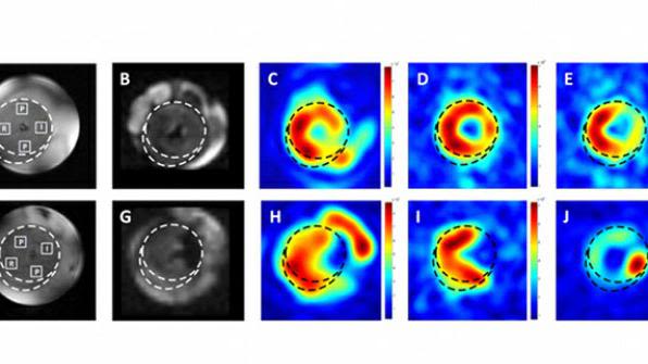 Development and Application of Cardiac Magnetic Resonance Imaging and Spectroscopy