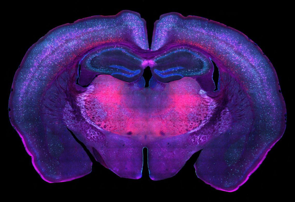 A colourful confocal image of a mouse-brain coronal section.